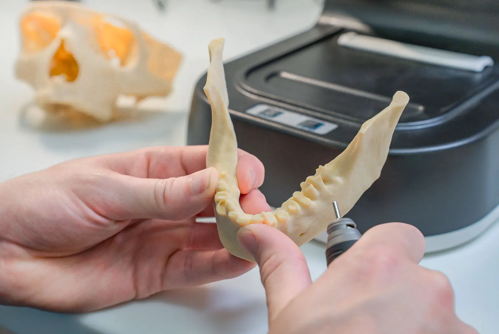 Modello di arcata stampato in 3D dal progetto digitale, rifinito a mano