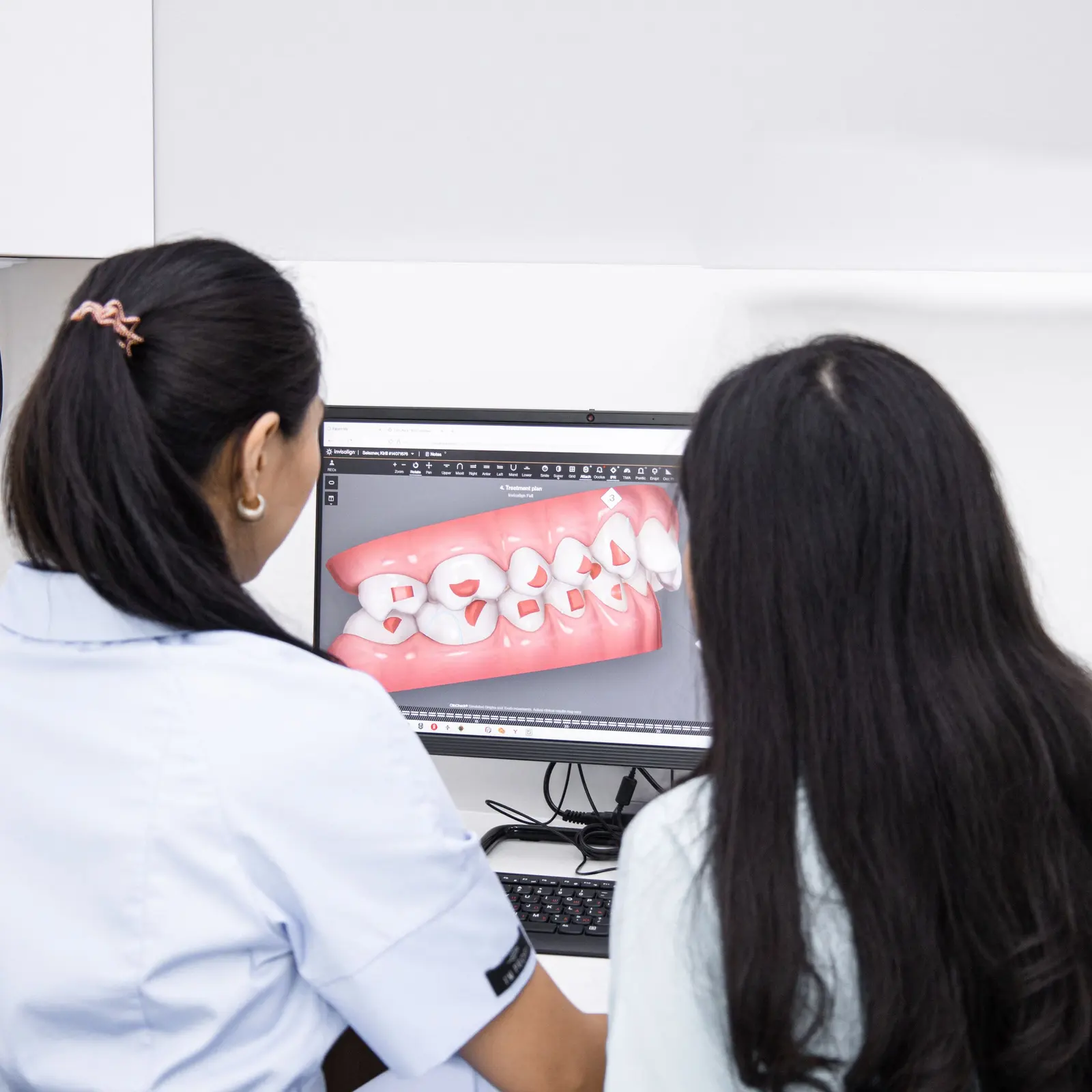 Due dentiste guardano un'arcata digitale sullo schermo del computer