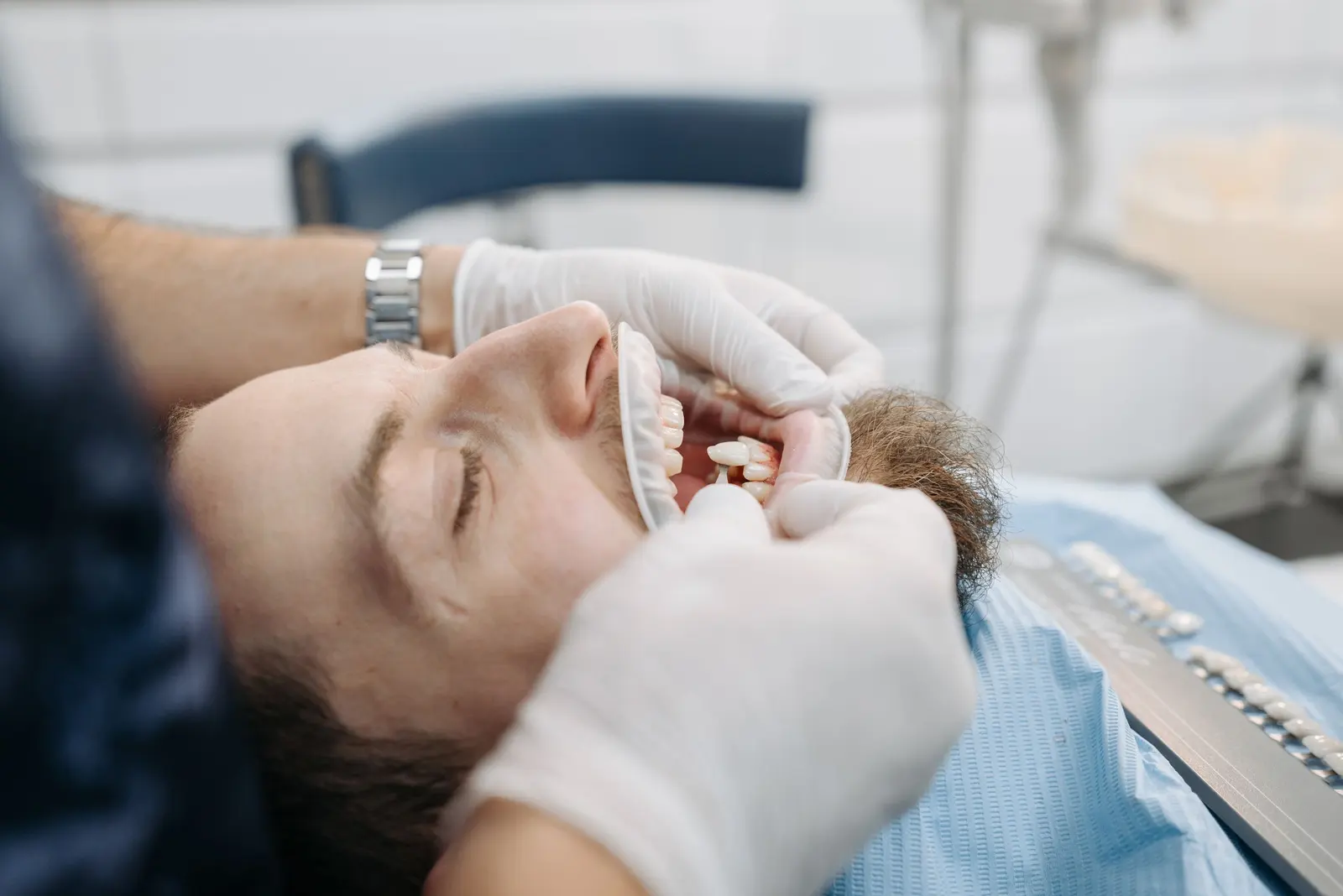La dentista prova la scala colori vicino ai denti del paziente